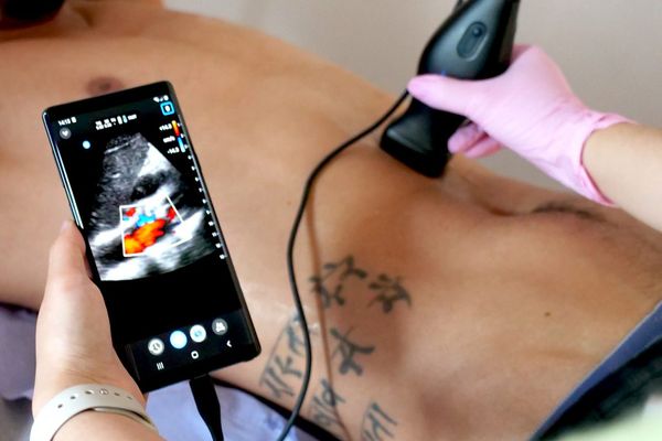 Ultrasound for Primary Care