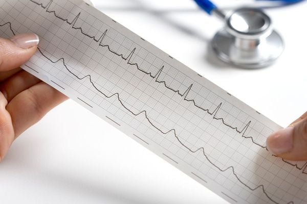 ECG Interpretation Course